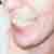 misc