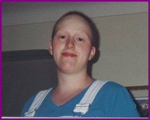Jenn with No Hair