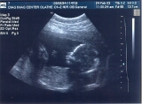 Ultrasound #1