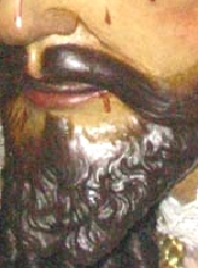 Jes�s De La Merced, ==Detalle Del Surco NasoLabial Izquierdo==