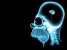As you can see he has the brain the size of a pea!
