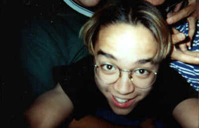 Look Ma!&nbsp; No Pimples!!&nbsp; J/k Mike