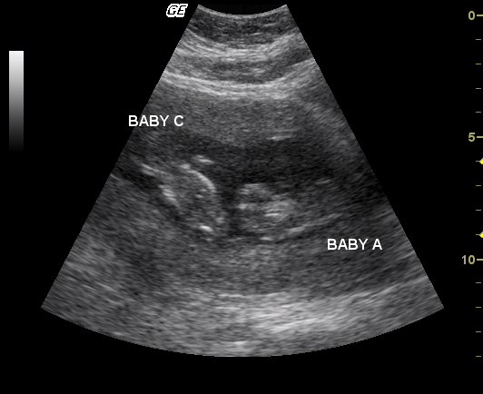 Image2