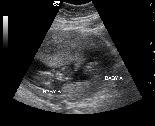 Image3