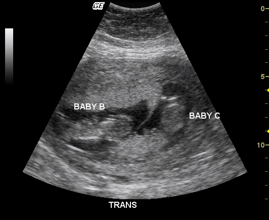 Image4