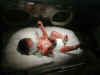 Nate getting photo/light therapy for jaundice   (53855 bytes)