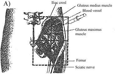 buttock