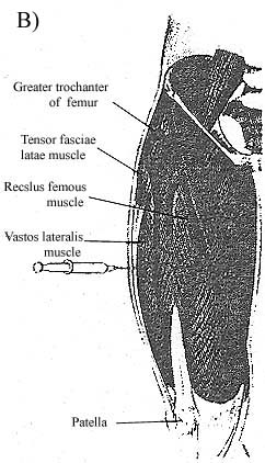 lateral surface of tigh