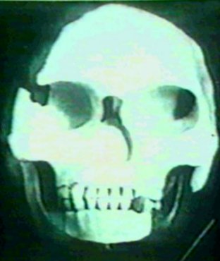 Piltdown man