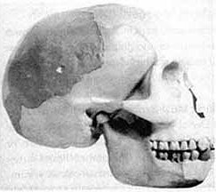 Piltdown man