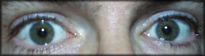 My EYES