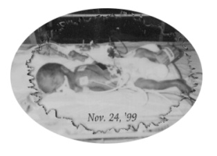 1 day old