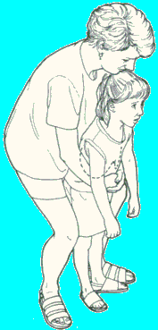 Maniobra de Heimlich