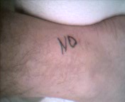 This ankle?