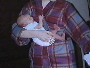 Rose's clubfoot again