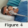 CPAP Mask