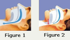 Normal; Obstructive Airway