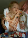 gianna after surgery.jpg (231069 bytes)