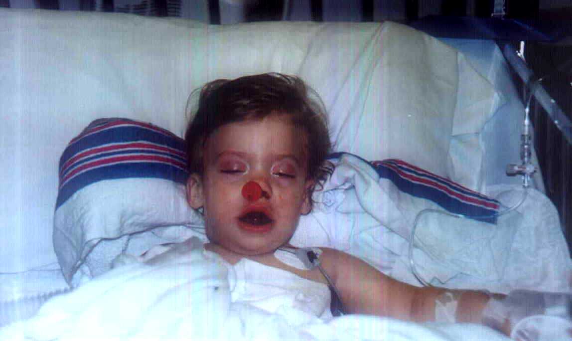 One hour after surgery