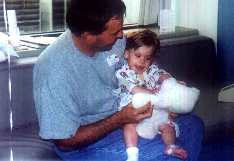 2 days after surgery
