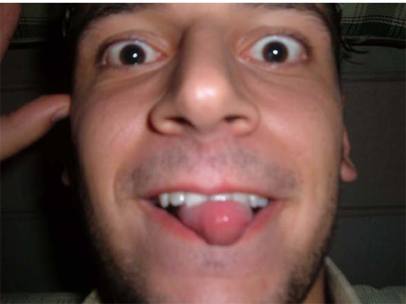 Abod being crazy