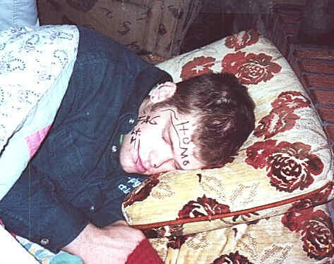 Kevin Murphy......... it ain't chicken pox dude!!