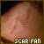 Fan of Harry Potter's Scar