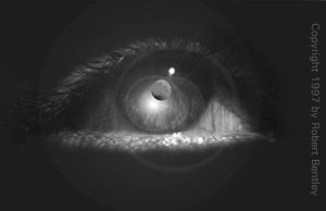Hey, this is my eye!