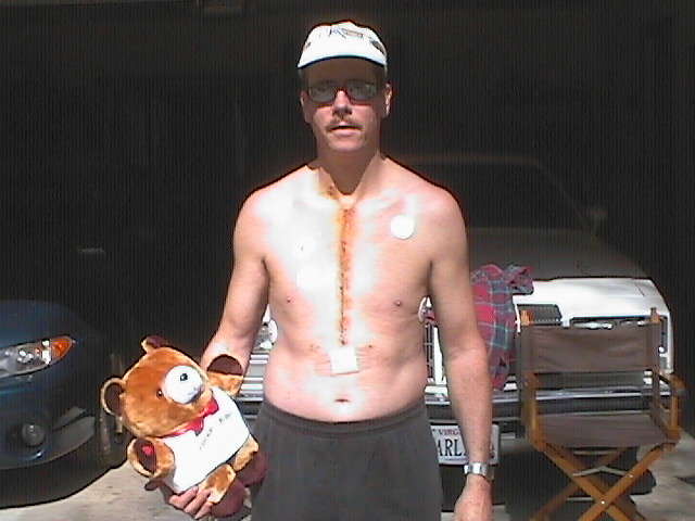 1 week after heart surgery! - April 16, 2001