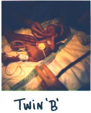 twin 'B'