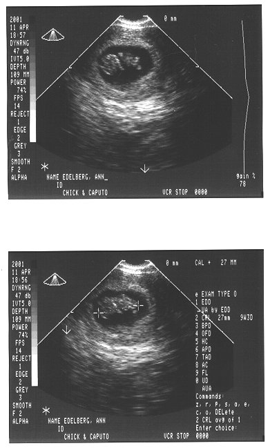 baby first photo.jpg (51452 bytes)