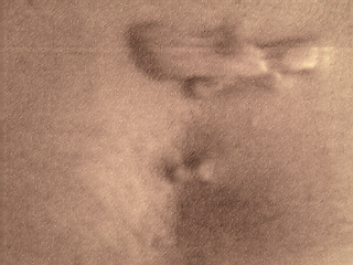 Close of the scar on my chest