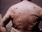 Image from Bristol Biomedical Image Archive