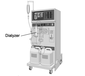 HEMODIALYSIS MACHINE