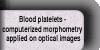 Blood platelets - computerized morphometry applied on optical images