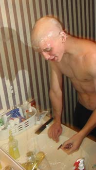 baldbrad