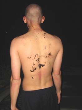 hairyback