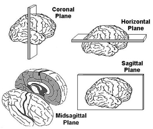 midsagittal plane