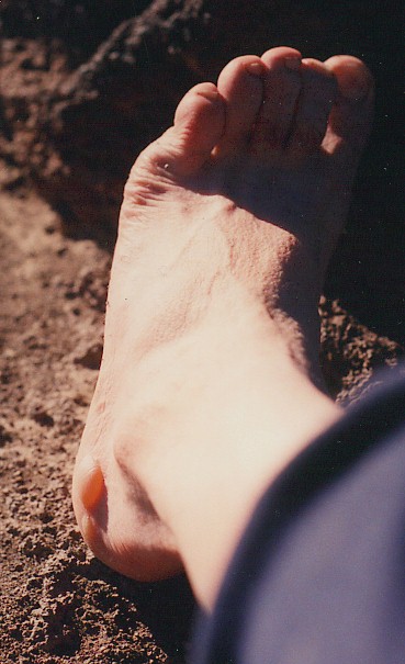 blister1.jpg