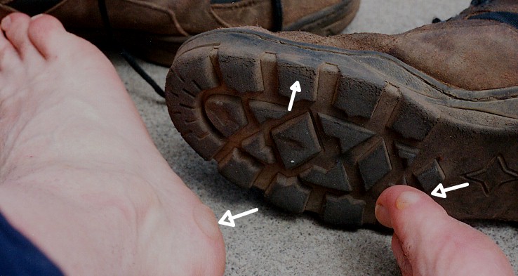 blister3.jpg