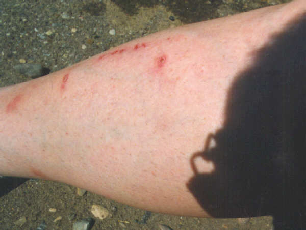 bites.jpg