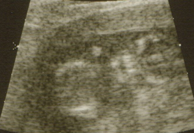 Boy or Girl?!?!