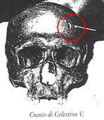 Cranio Celestino V - Collemaggio - L'Aquila - Abruzzo - Italia