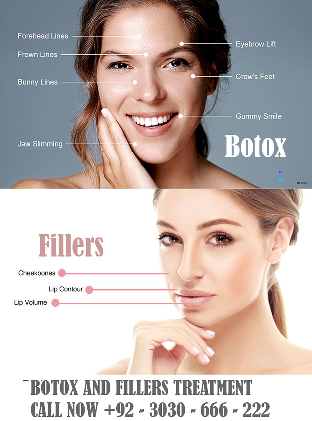 Botox and Fillers NOW +92-3030-666-222