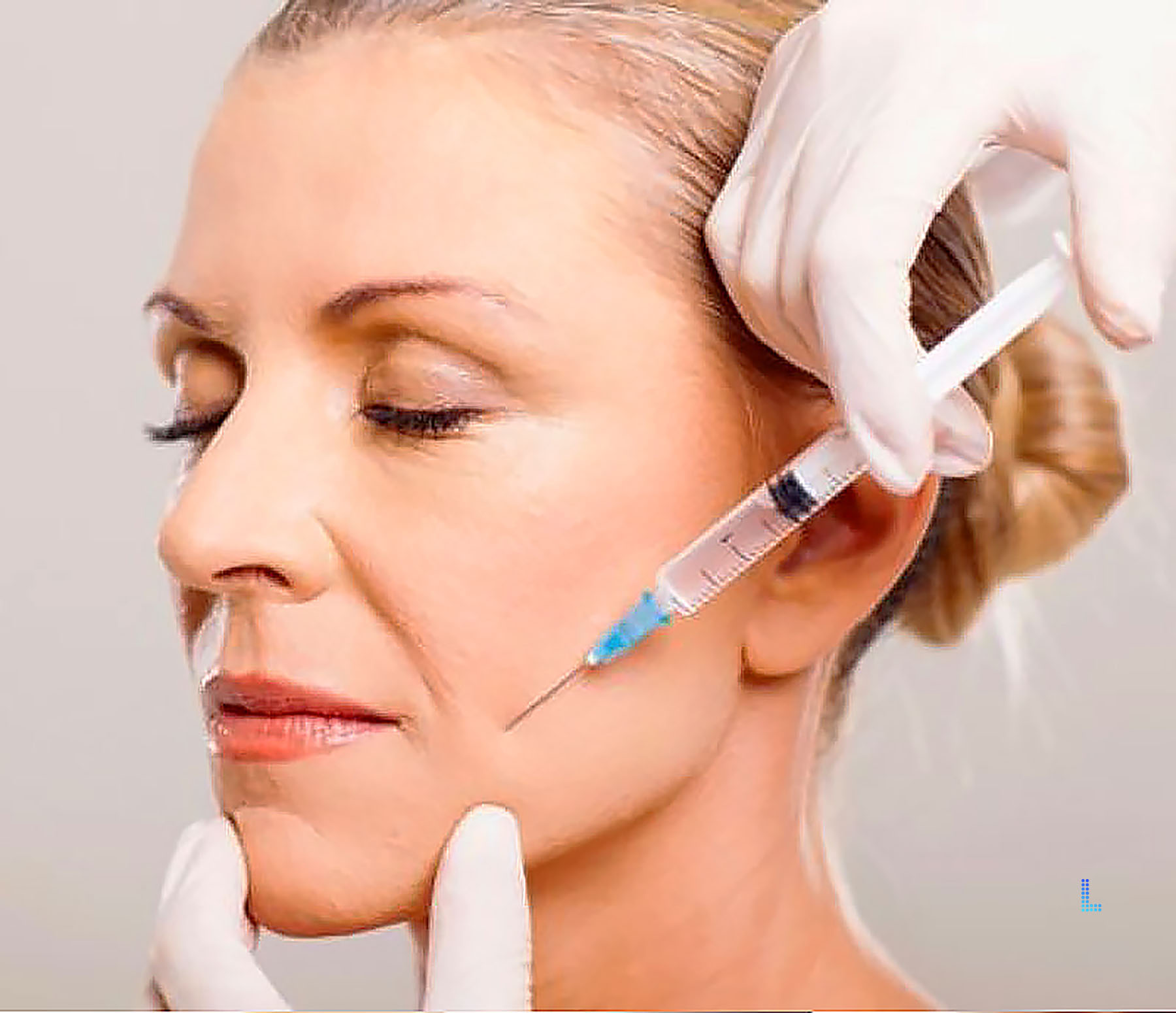 Dermabrasion in Lahore