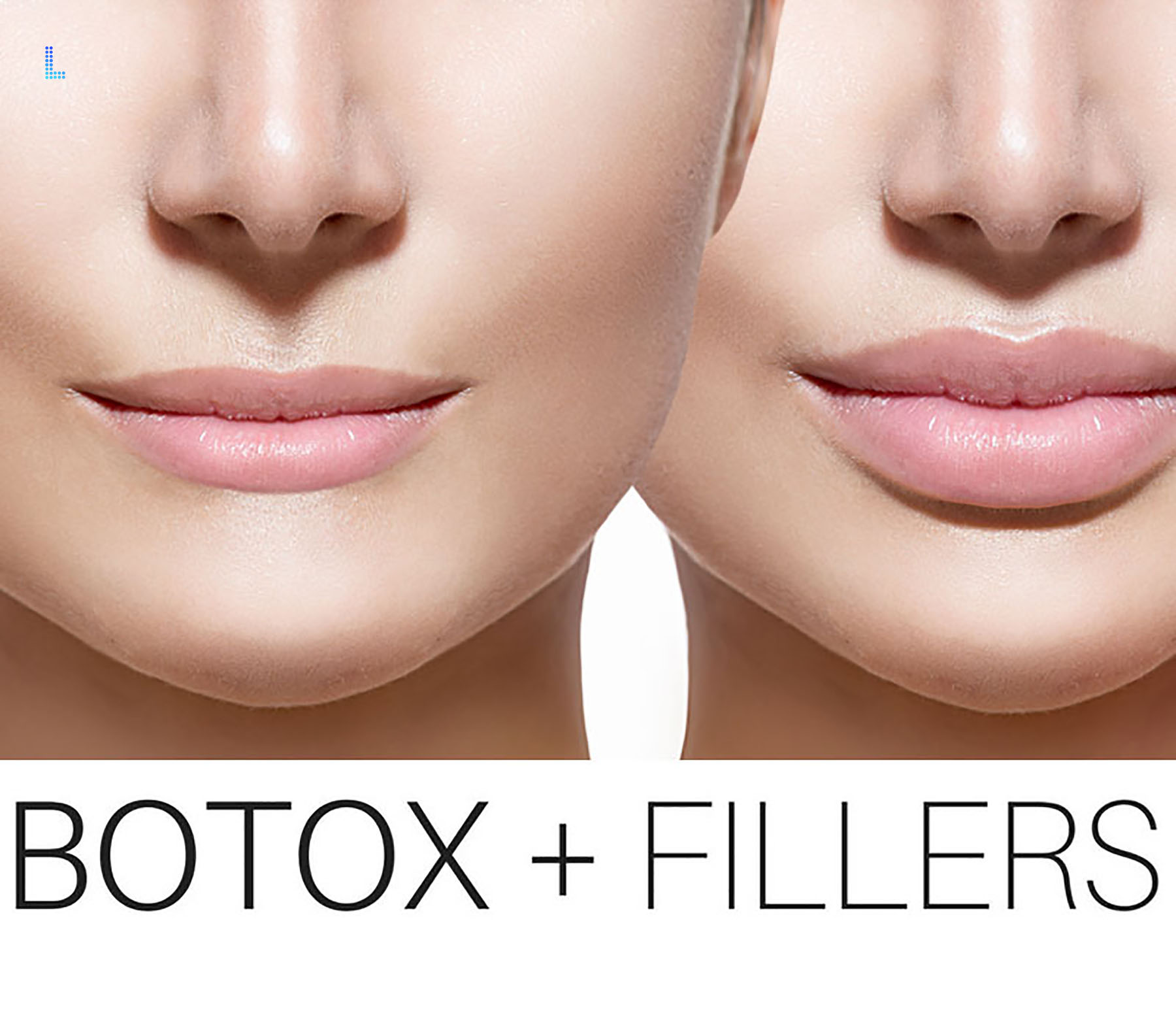 Best Cosmetic  Lip Enhancement in Lahore