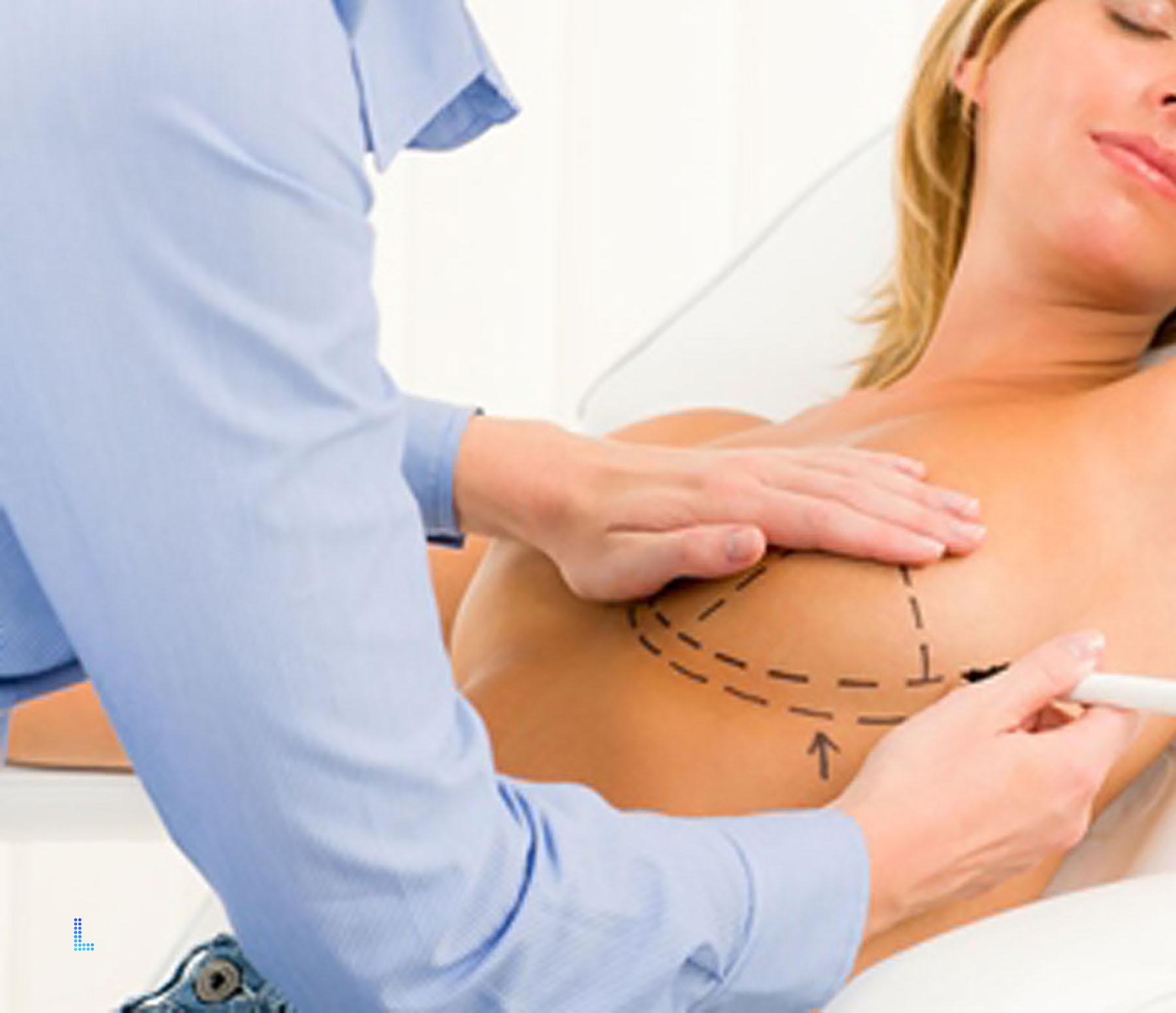 Ideal Patients for breast surgery