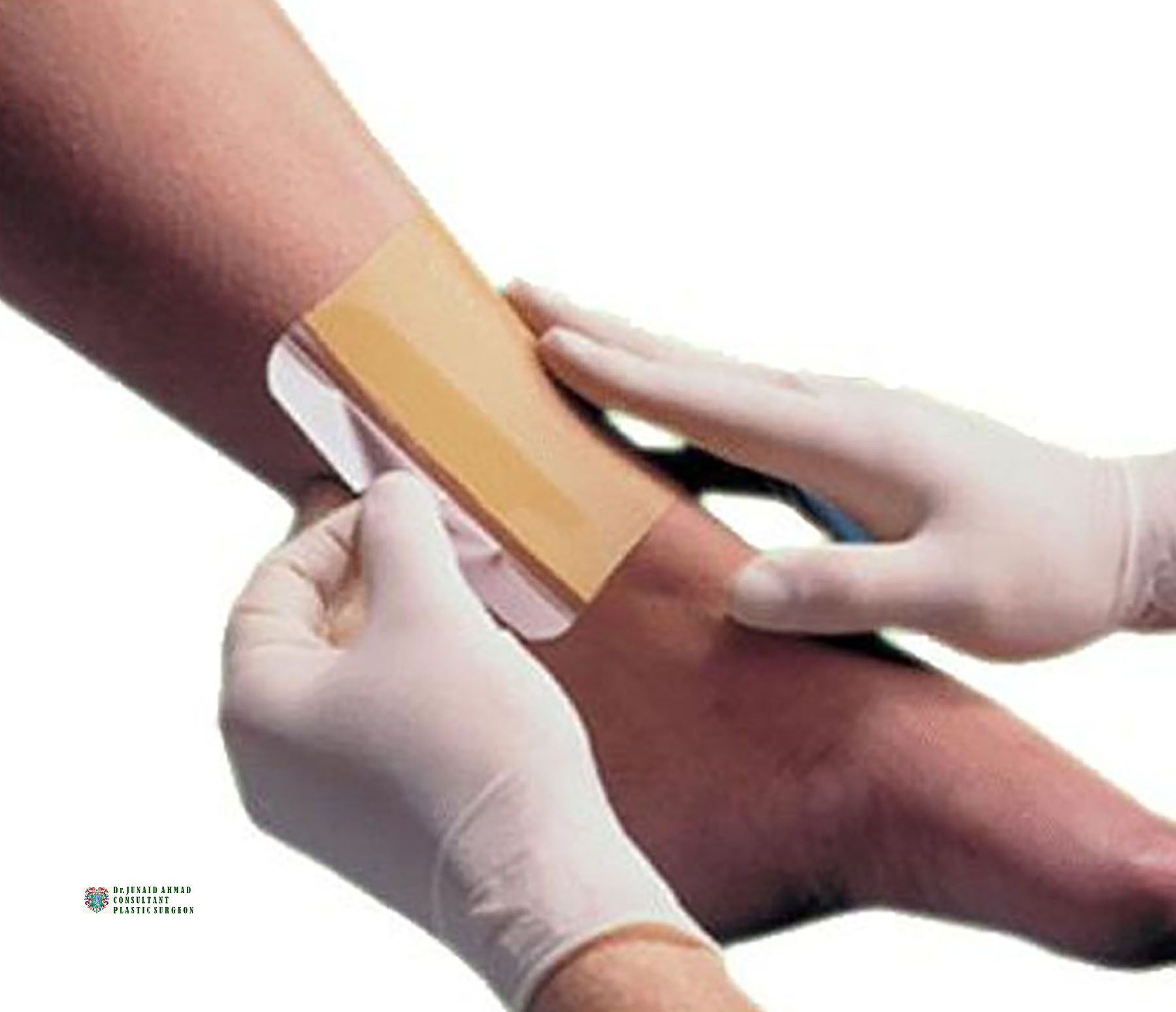 Burn treatment in Lahore