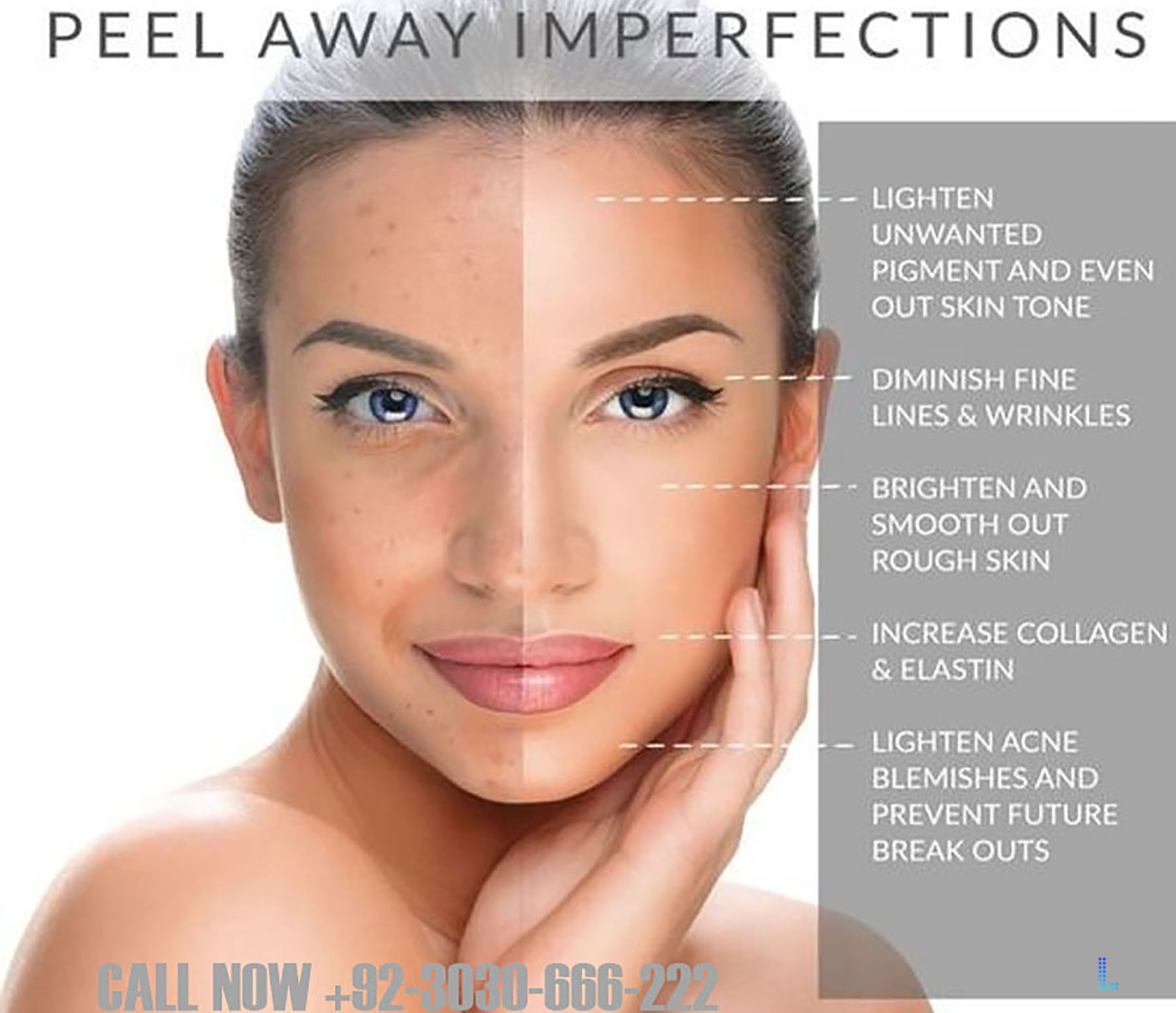 Chemical Peels and Medicated Facial in Lahore