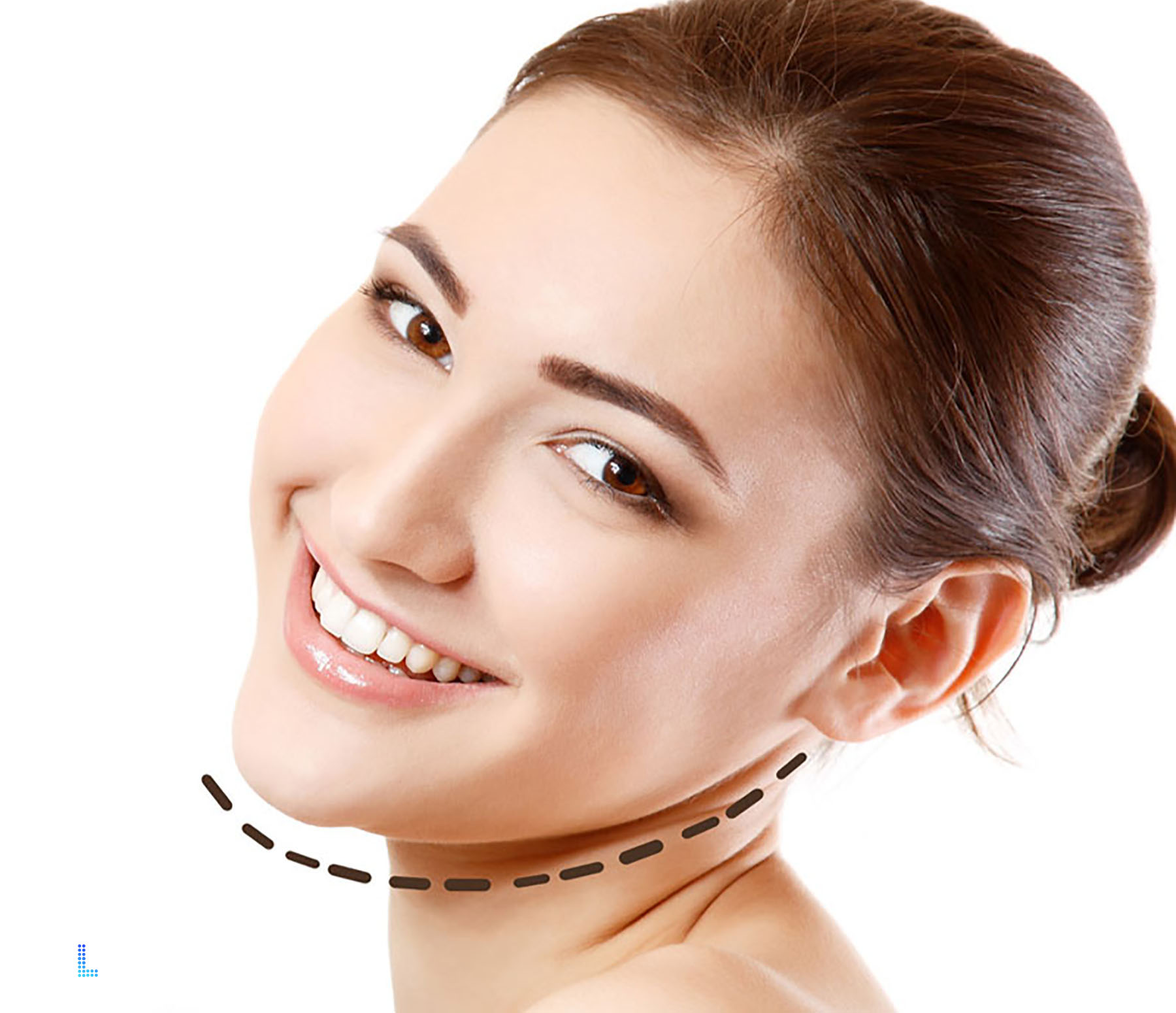Best Cosmetic Double Chin Removal in Lahore